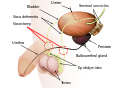 Vasectomy diagram-en.svg